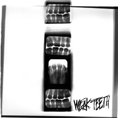 (image for) Weak Teeth 7" - Click Image to Close